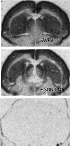 Microarray Analysis Of Neonatal Rat Anteroventral Periventricular Transcriptomes Identifies The