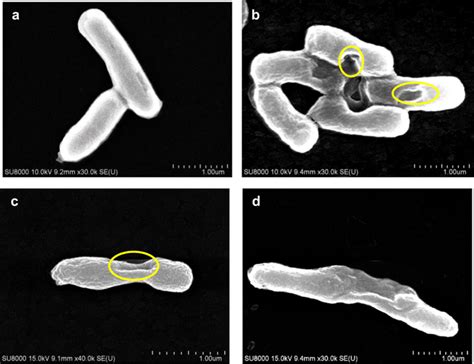 SEM Images Of E Coli During The Photocatalysis Treatment With