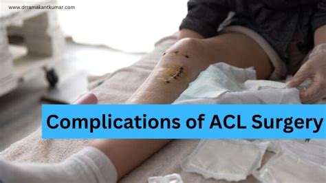 Common Acl Surgery Complications 6 After Surgery Risks