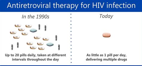 Hiv Treatment Development Extends Life Expectancy By 10 Years