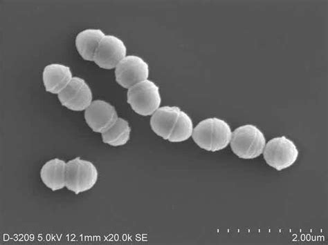 「人食いバクテリア」劇症型溶血性レンサ球菌感染症が過去最多（22ページ） 産経ニュース