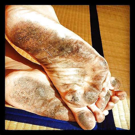 Feet Dirty Soles Porn Pictures XXX Photos Sex Images PICTOA