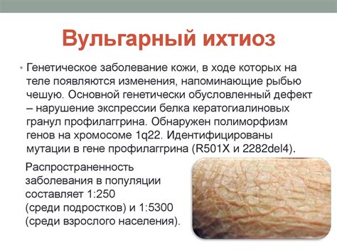 Ихтиоз - презентация онлайн