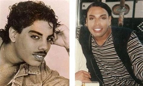 Photos Handsome Man Turns Into Old Woman After Sex Change Surgery Went Wrong Naijagists