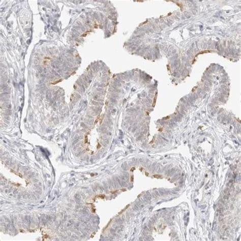G Protein Alpha Antibody Novus Biologicals™ 01ml Unlabeled Fisher