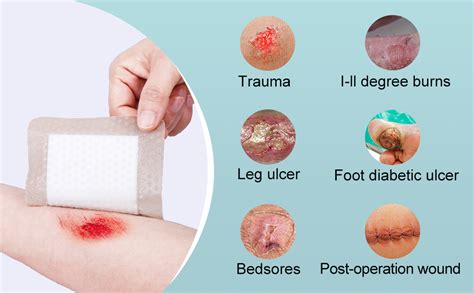 amazoncom  pcs silicone foam dressing  gentle border waterproof