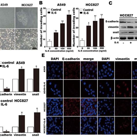 Il 6 Promotes Lung Carcinoma Cell Invasion And Emt A A549 And Hcc827