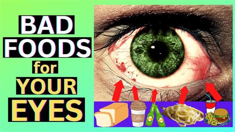 Eye Health Foods 10 Worst Foods For Your Eyes Foods To Avoid For Better Vision Youtube