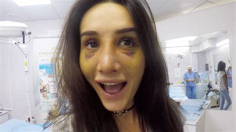 Семейная Жизнь. Новый Нос. Подготовка К Новому Году. - YouTube