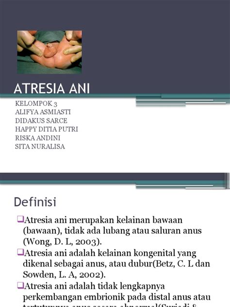 Atresia Ani Pdf