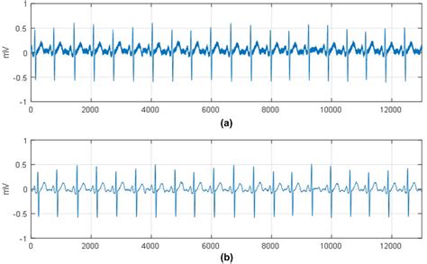 A Raw Ecg Signal With Noise And B Filtered By Gaussian Weighted Moving