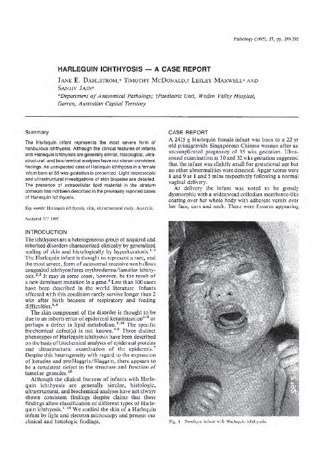 (PDF) Harlequin ichthyosis — A case report | Mohammed Desai - Academia.edu