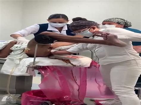 Doctors Remove Massive Dildo TheYNC