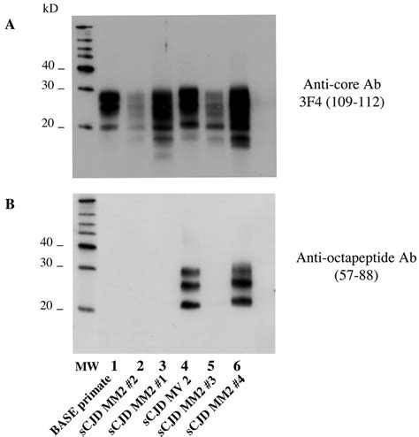 Electrophoretic Analysis And Differential Sensitivity To Proteolysis Of