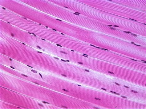 Skeletal Muscle Histology Labeled - vrogue.co