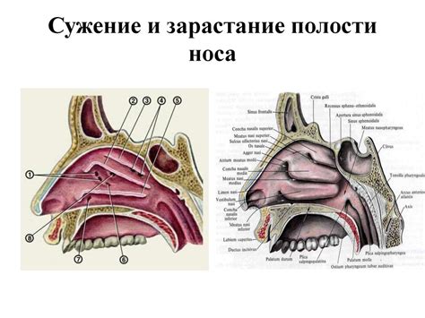 Патология органов речи, слуха и зрения - презентация онлайн