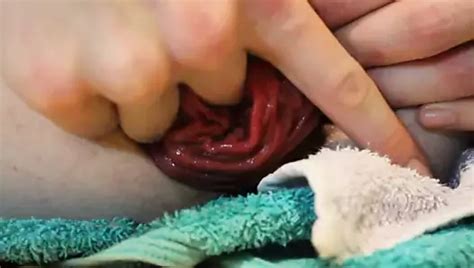 Extreme Eggplant Anal Free Gay Amateur Porn E5 XHamster