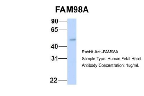 FAM98A Antibody, Novus Biologicals 0.05mg; Unlabeled:Antibodies ...