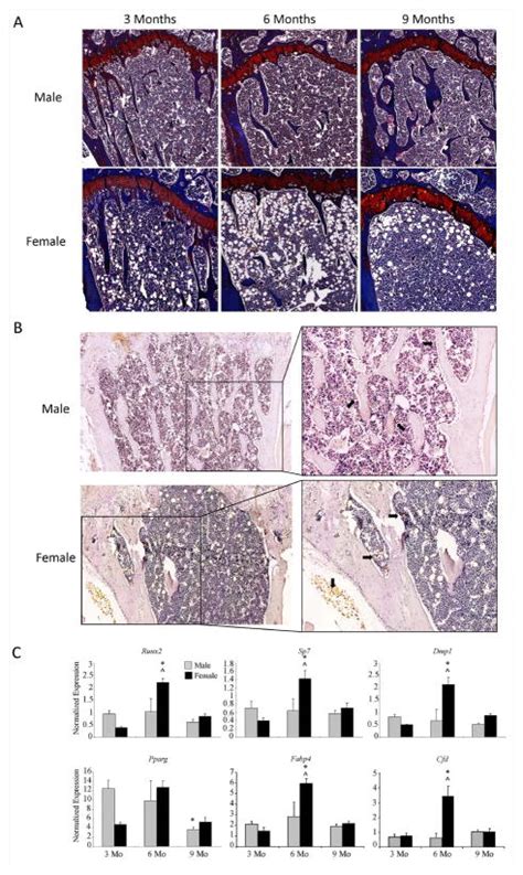 Intrinsic Sex Linked Variations In Osteogenic And Adipogenic Differentiation Potential Of Bone