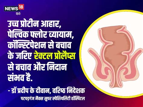 Health Tips महिलाओं में आम होती रेक्‍टल प्रोलैप्‍स बीमारी के लक्षण