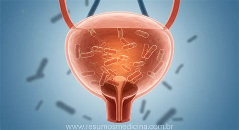 O Que É Bacteriúria - Bacteriúria Assintomática: O Que É, Quando Tratar e Como Manejar ...