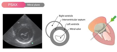 Standard Transthoracic Echocardiogram Complete Imaging Protocol