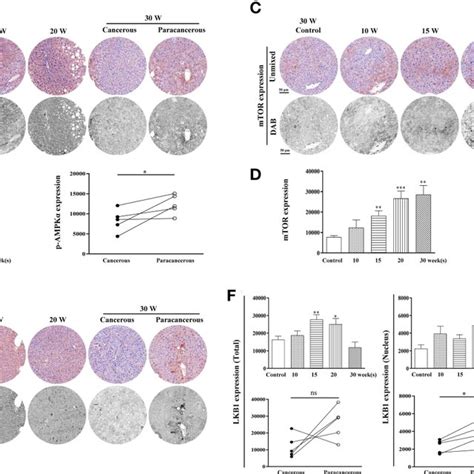 Immunohistochemical Staining Of P Ampk Mtor And Lkb Proteins In