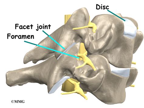 Right Neural Foramen