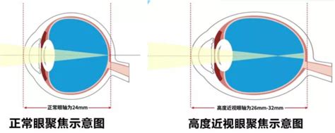 宁姐137空中课堂｜预防近视，从了解儿童视觉发育特点开始 澎湃号·政务 澎湃新闻 The Paper