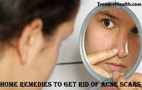 Effortlessly Erase Facial Scars: Quick Natural Remedies Revealed - Hunter Games Magazine