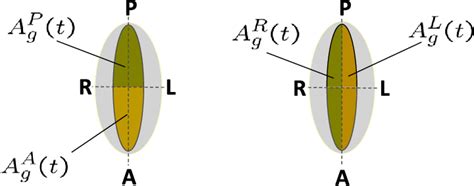 Schematic Representation Of Sagittal Hemi GAWs Left And Lateral