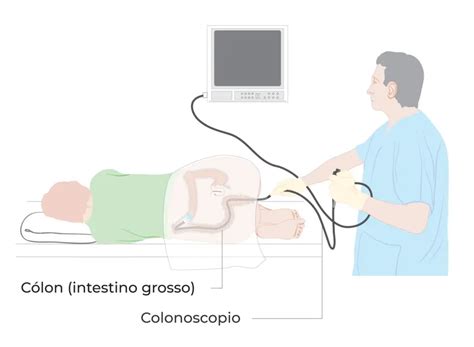 Como Se Escreve Colonoscopia - Tudo sobre a colonoscopia