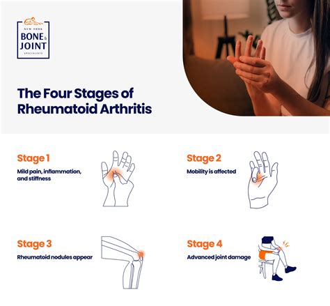 The Four Stages of Rheumatoid Arthritis - New York Bone & Joint Specialists