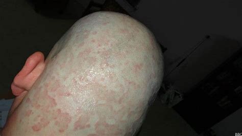 G1 Iraquiano gay relata como escapou de ser atirado de prédio pelo EI notícias em Mundo