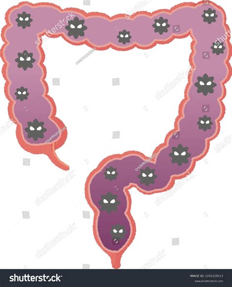 Colitis Disease Unknown Cause Which Chronic Stock Vector (Royalty Free