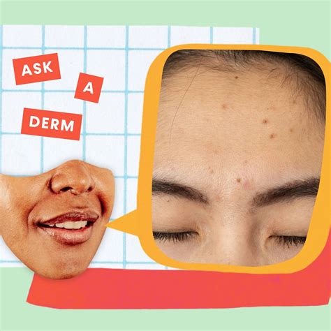 Skin Care Treatments, Tips & Advice | SELF