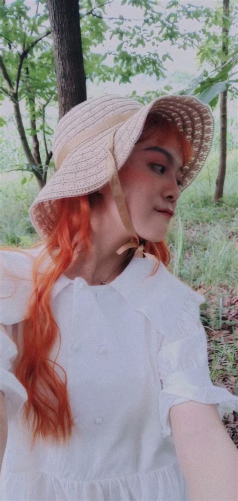 Hot girl với vết chàm lớn trên mặt trở thành mẫu lookbook nổi tiếng Con gái xinh nhất khi tự