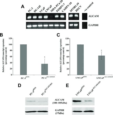 Alcam Expression And Targeting In Prostate Cancer Cell Lines Rt Pcr Download Scientific