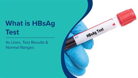 ESR Test: Normal Range, Symptoms, and Causes of High Levels | MaxAtHome