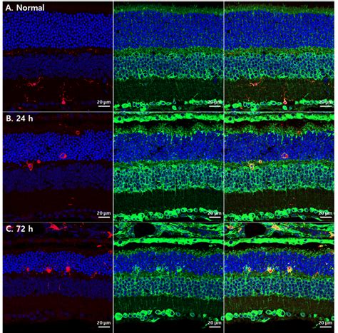 Grp Expression In Microglial Cells In Blue Led Induced Rd Retinas