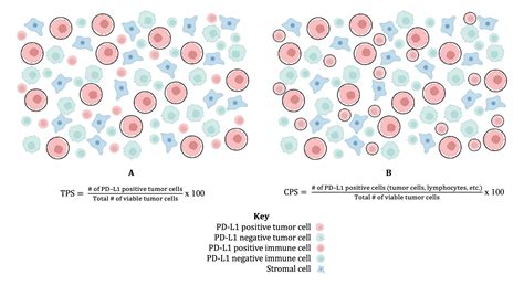 Defining PD L1 Expression In Gastric Cancer How Positive Is CPS For