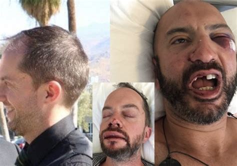 Brutal ataque homófobo a una pareja gay de vacaciones en Mykonos CromosomaX