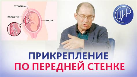 Прикрепление плодного яйца по передней стенке. Что это значит? Отвечает ...