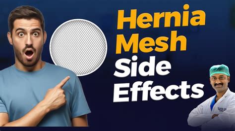 Hernia Mesh Side Effects | Hernia Mesh Failure Symptoms & Treatment