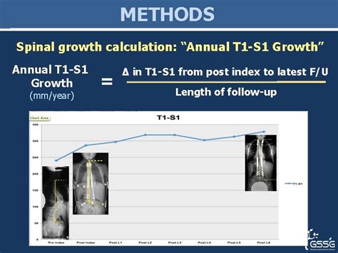 Traditional Growing Rods Versus Magnetically Controlled Growing Rods