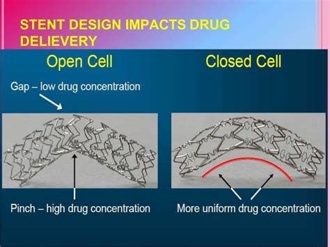 Drug eluting stent | PPT