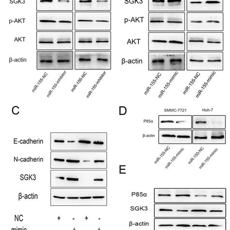 Mir 155 Stimulates Emt Through By Targeting P85α To Activate Sgk3 The