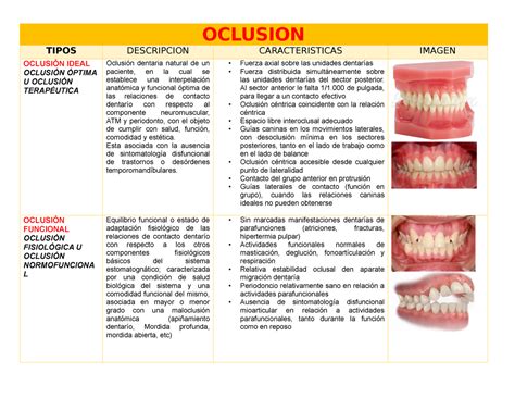 Los Diferentes Tipos De Oclusi N Oclusion Tipos Descripcion