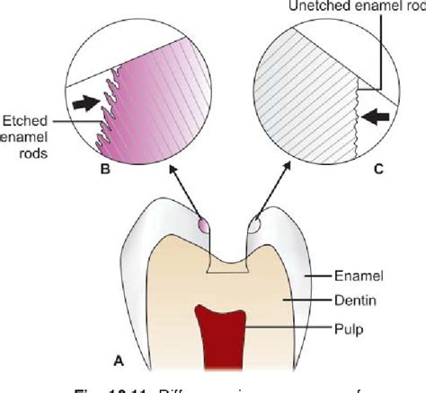 Pdf Bonding To Enamel And Dentin Semantic Scholar