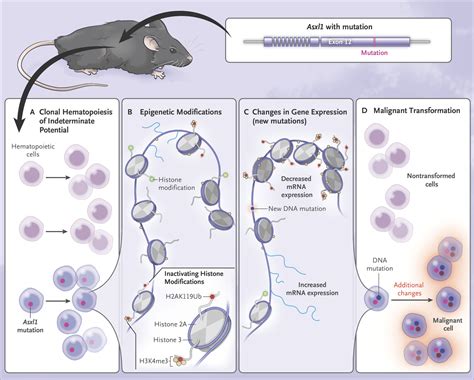 Tipping Clonal Hematopoiesis Into Transformation New England Journal